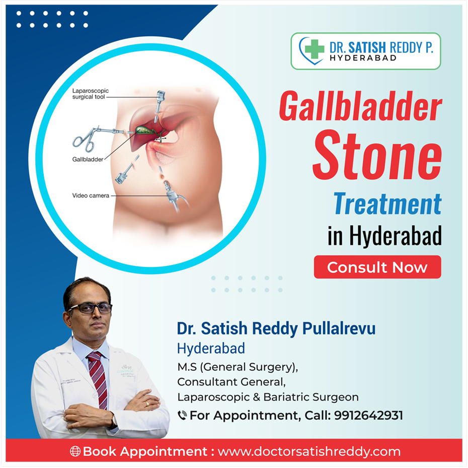 Gall Bladder (Biliary) Stone Treatment