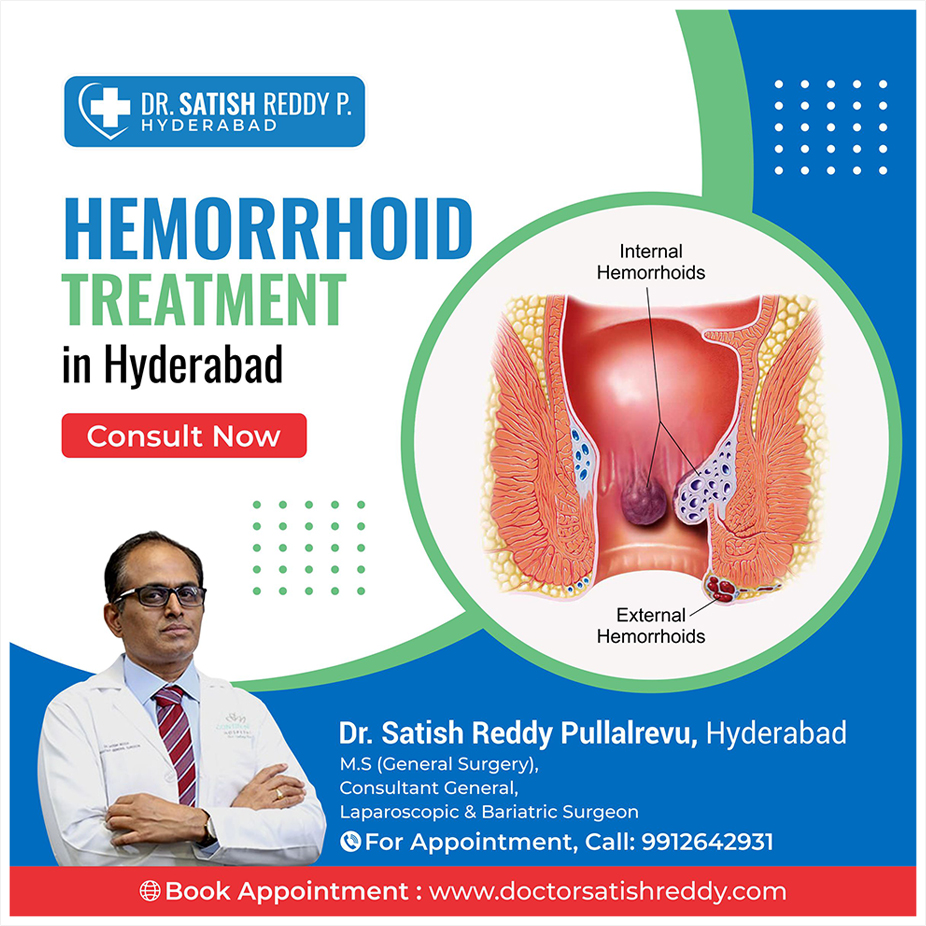 Hemorrhoids Treatment