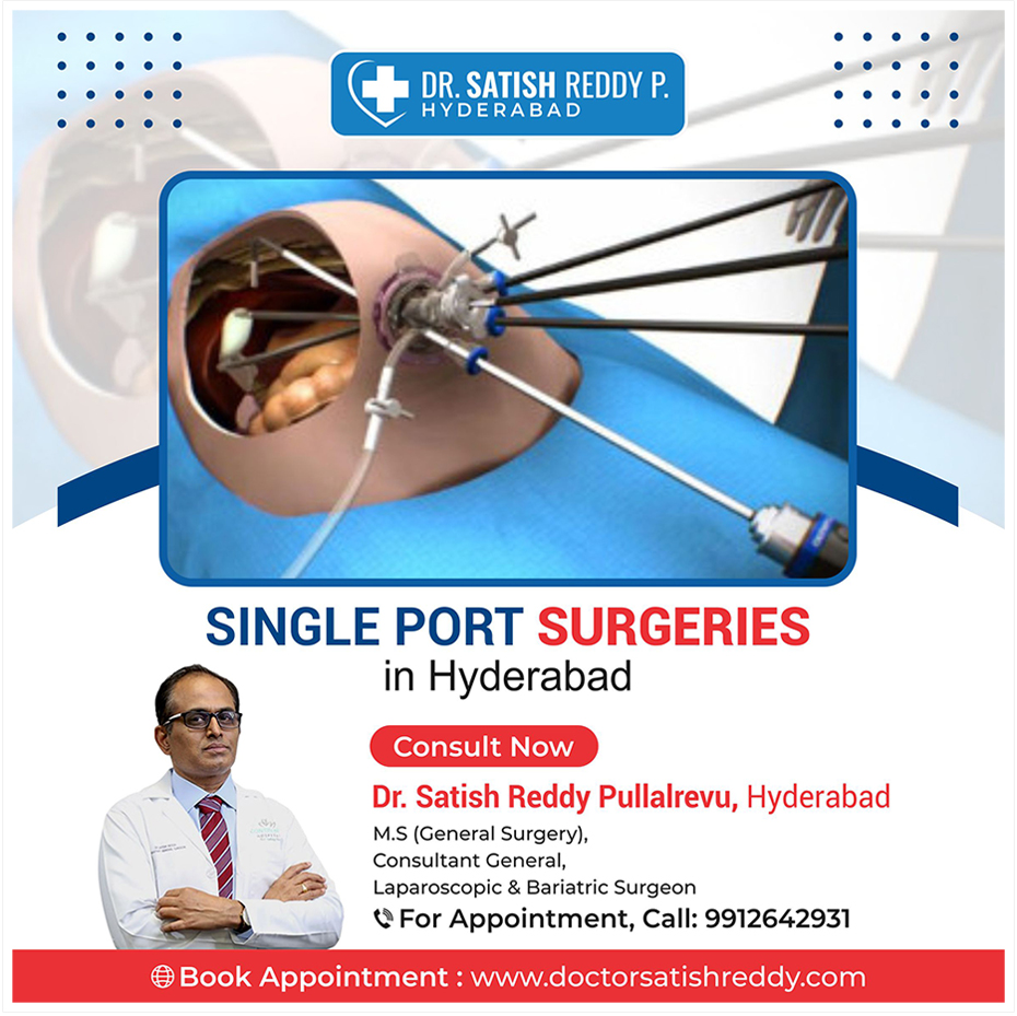 Single Port Surgeries